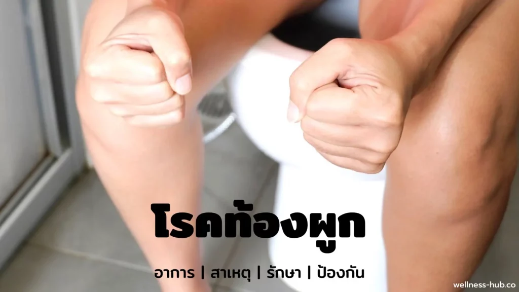 ท้องผูก | อาการ-สาเหตุ-รักษา-ป้องกัน