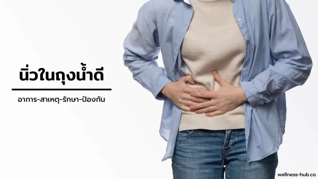 นิ่วในถุงน้ำดี Gallstone