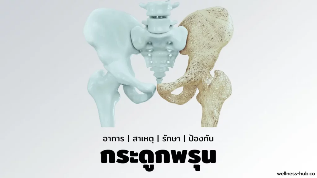 โรคกระดูกพรุน | อาการ-สาเหตุ-รักษา-ป้องกัน